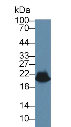 Polyclonal Antibody to Heat Shock Protein Beta 6 (HSPb6)