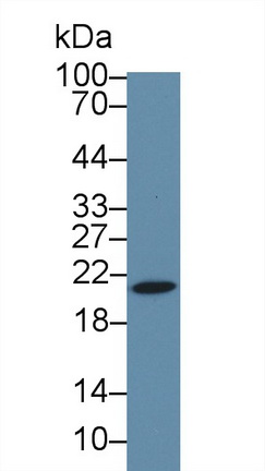 Polyclonal Antibody to Heat Shock Protein Beta 6 (HSPb6)