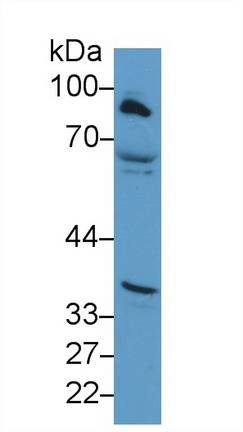 Polyclonal Antibody to Carnitine Palmitoyltransferase 1A, Liver (CPT1A)