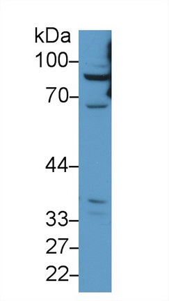 Polyclonal Antibody to Carnitine Palmitoyltransferase 1A, Liver (CPT1A)