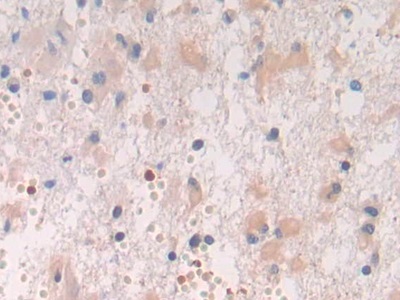 Polyclonal Antibody to Spondin 2 (SPON2)