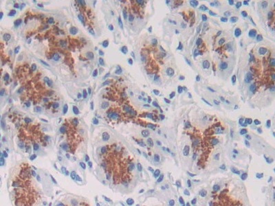 Polyclonal Antibody to Spondin 2 (SPON2)