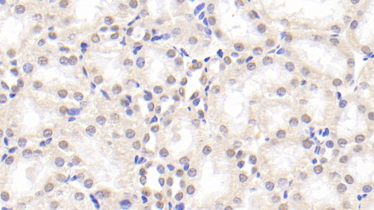 Polyclonal Antibody to Spondin 2 (SPON2)