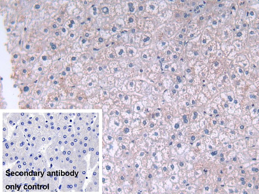 Polyclonal Antibody to Fatty Acid Desaturase 2 (FADS2)