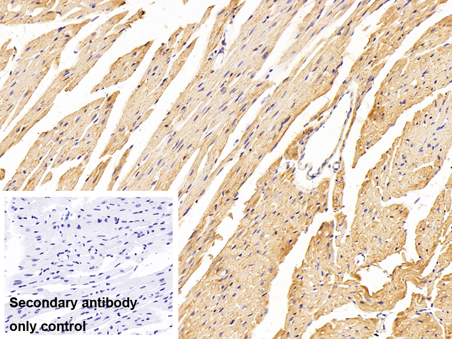 Polyclonal Antibody to Fatty Acid Desaturase 2 (FADS2)