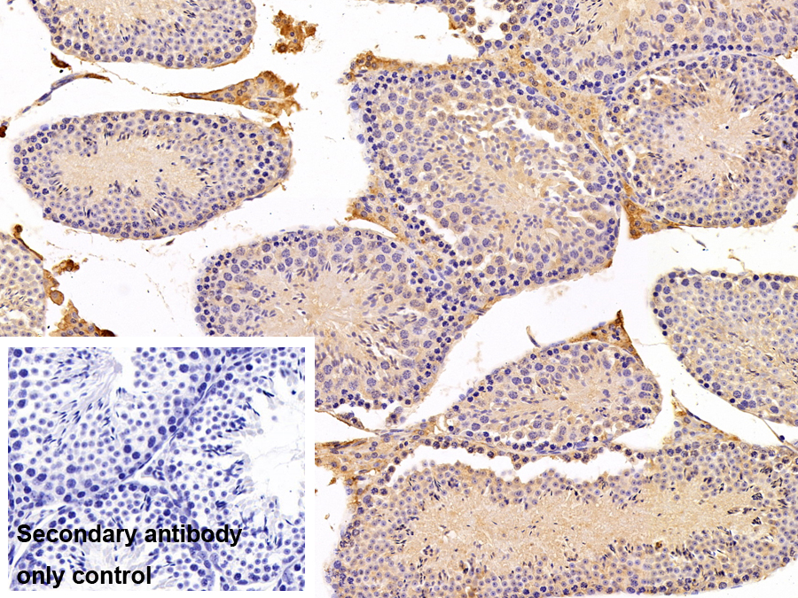 Polyclonal Antibody to Fatty Acid Desaturase 2 (FADS2)