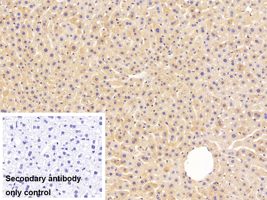 Polyclonal Antibody to Fatty Acid Desaturase 2 (FADS2)