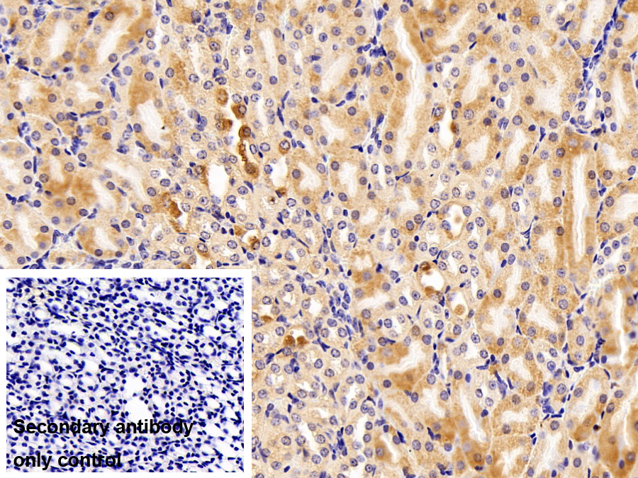 Polyclonal Antibody to Fatty Acid Desaturase 2 (FADS2)