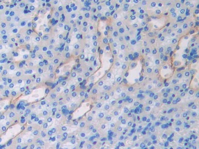 Polyclonal Antibody to Fibulin 4 (FBLN4)