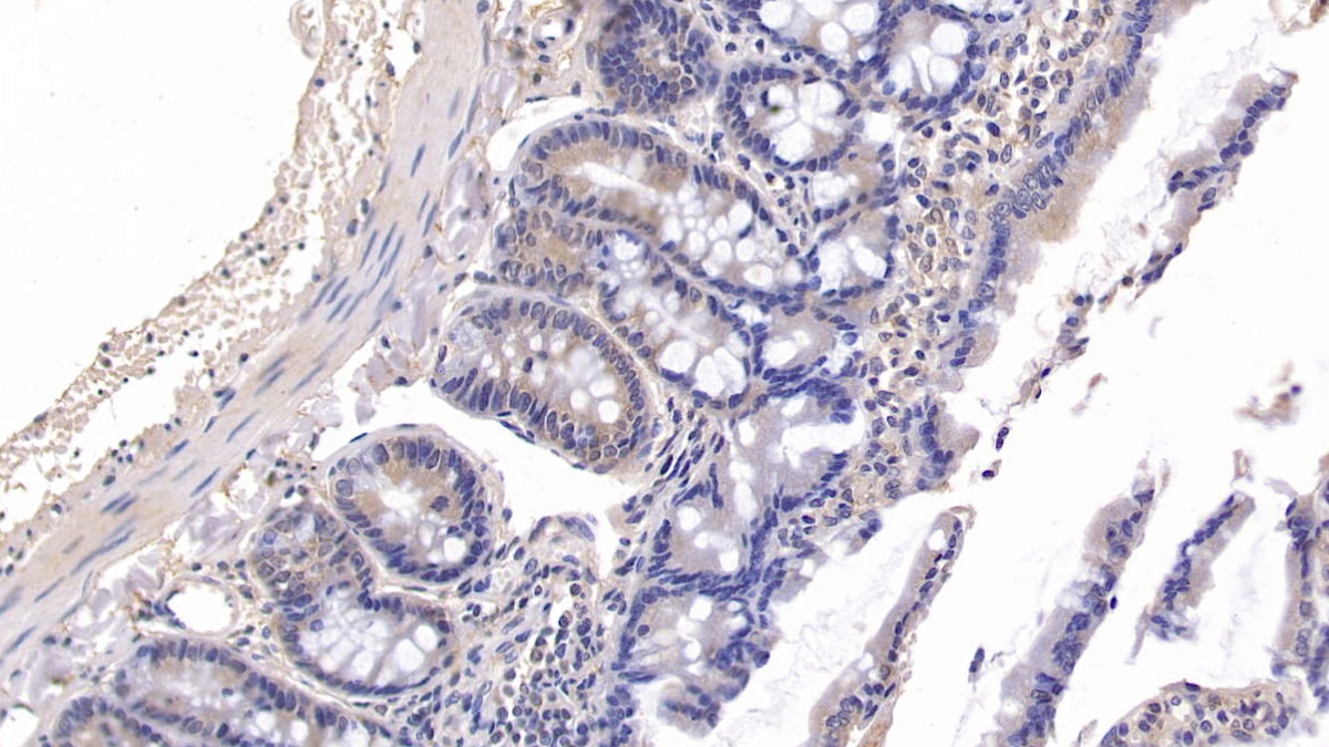 Polyclonal Antibody to Fibulin 3 (FBLN3)