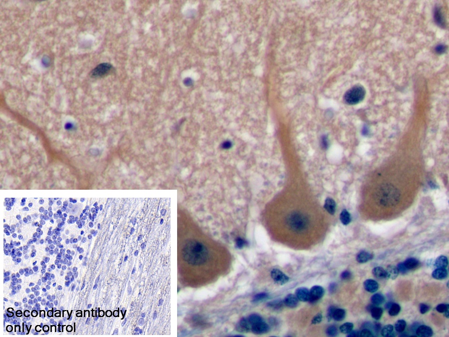 Polyclonal Antibody to Tetraspanin 1 (TSPAN1)