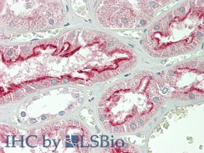 Polyclonal Antibody to Folate Receptor 1, Adult (FOLR1)