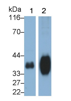 Polyclonal Antibody to Folate Receptor 1, Adult (FOLR1)