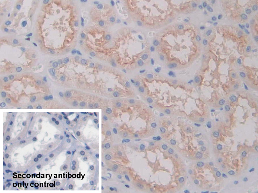 Polyclonal Antibody to Folate Receptor 1, Adult (FOLR1)