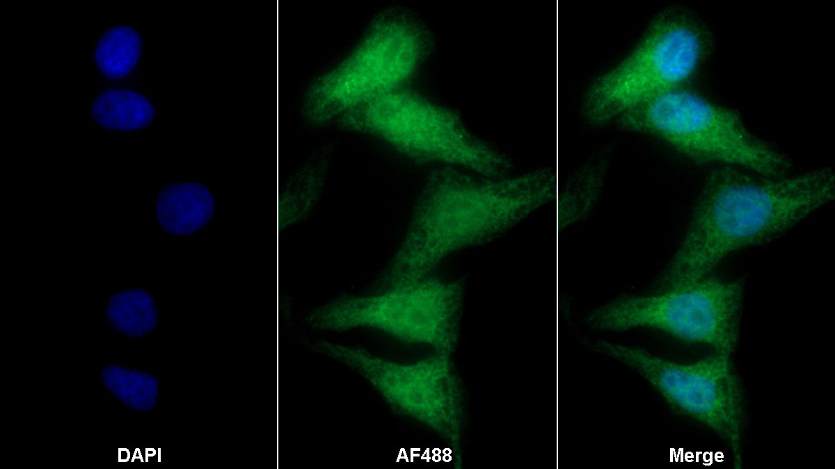 Polyclonal Antibody to Folate Receptor 1, Adult (FOLR1)