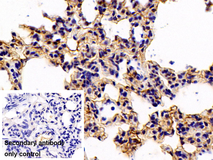 Polyclonal Antibody to Folate Receptor 1, Adult (FOLR1)