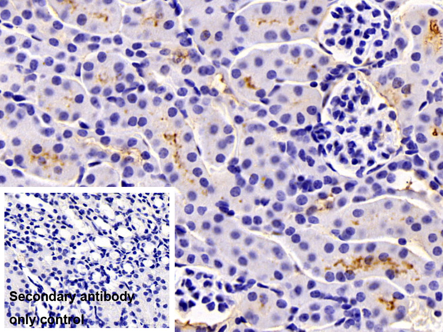 Polyclonal Antibody to Folate Receptor 1, Adult (FOLR1)