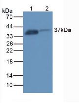 Polyclonal Antibody to Folate Receptor 1, Adult (FOLR1)