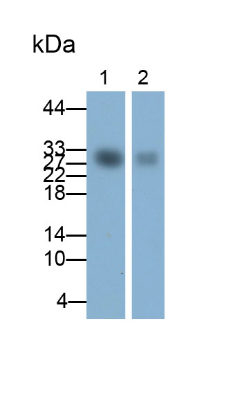 Polyclonal Antibody to Folate Receptor 1, Adult (FOLR1)