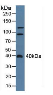 Polyclonal Antibody to Centaurin Alpha 2 (CENTa2)