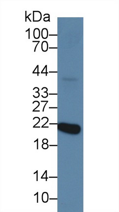 Polyclonal Antibody to Recoverin (RCVRN)