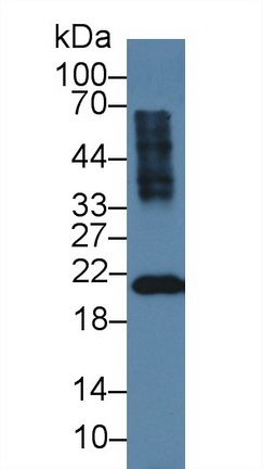 Polyclonal Antibody to Recoverin (RCVRN)