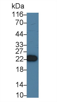 Polyclonal Antibody to Recoverin (RCVRN)