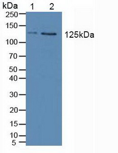 Polyclonal Antibody to Janus Kinase 2 (JAK2)