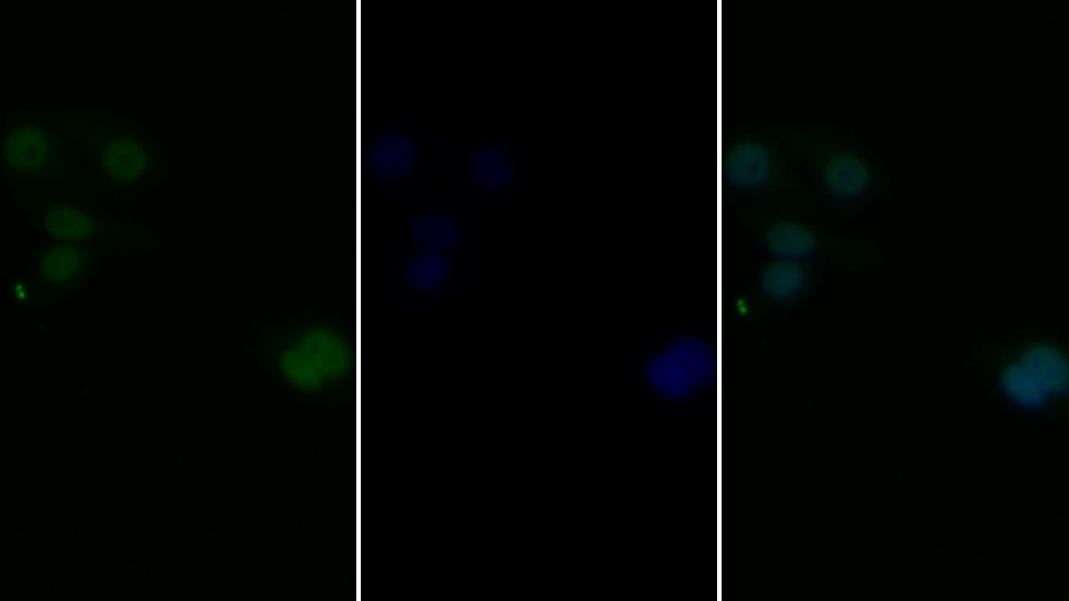 Polyclonal Antibody to Janus Kinase 2 (JAK2)