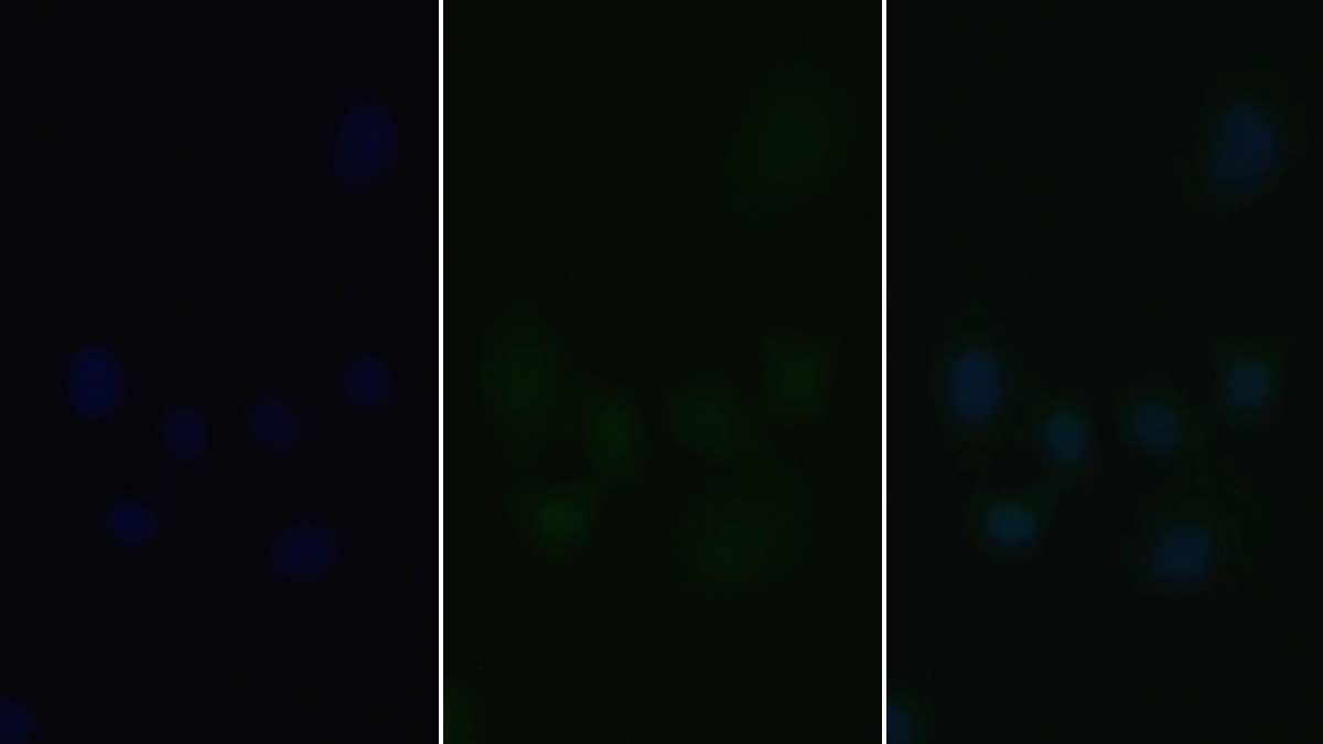 Polyclonal Antibody to Janus Kinase 2 (JAK2)