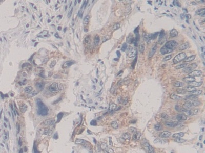 Polyclonal Antibody to Kinesin Family, Member 18A (KIF18A)