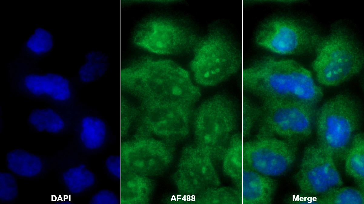 Polyclonal Antibody to Kinesin Family, Member 18A (KIF18A)