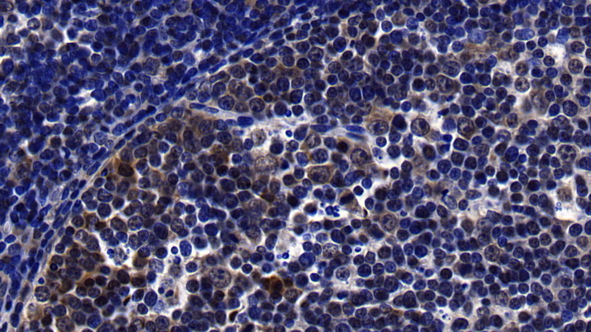 Polyclonal Antibody to Leukocyte Cell Derived Chemotaxin 2 (LECT2)