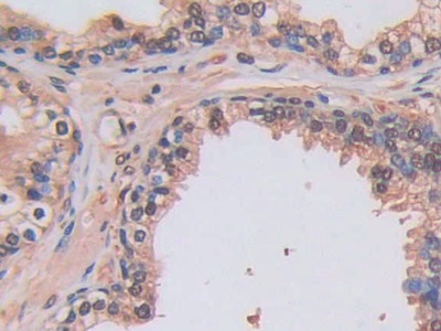 Polyclonal Antibody to Lysyl Oxidase Like Protein 2 (LOXL2)