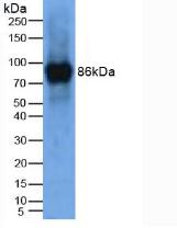 Polyclonal Antibody to Lysyl Oxidase Like Protein 2 (LOXL2)