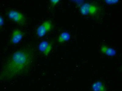 Polyclonal Antibody to Lysyl Oxidase Like Protein 2 (LOXL2)