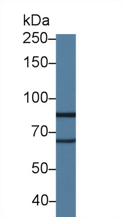 Polyclonal Antibody to Lysyl Oxidase Like Protein 2 (LOXL2)