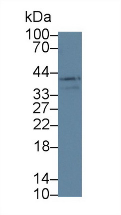 Polyclonal Antibody to Lysyl Oxidase Like Protein 3 (LOXL3)