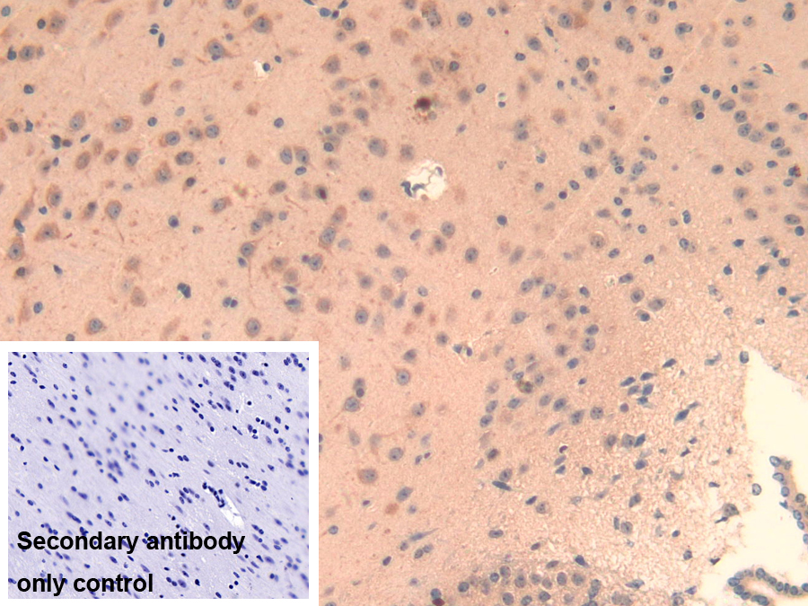 Polyclonal Antibody to Lysyl Oxidase Like Protein 3 (LOXL3)