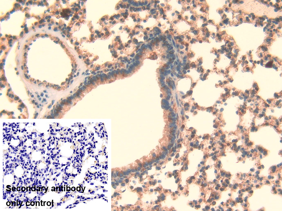 Polyclonal Antibody to Lysyl Oxidase Like Protein 3 (LOXL3)