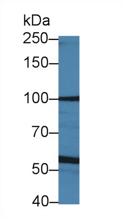 Polyclonal Antibody to Lysyl Oxidase Like Protein 4 (LOXL4)