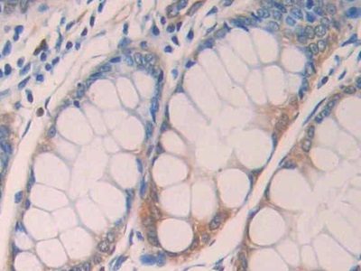 Polyclonal Antibody to Lysyl Oxidase Like Protein 4 (LOXL4)