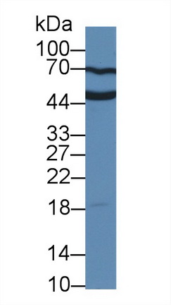 Polyclonal Antibody to Uroplakin 3A (UPK3A)