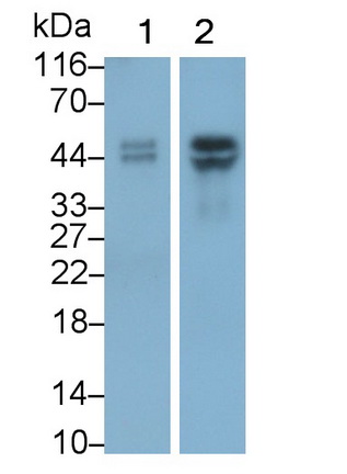 Polyclonal Antibody to Uroplakin 3A (UPK3A)