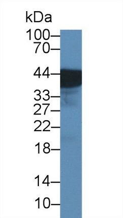 Polyclonal Antibody to Uroplakin 3A (UPK3A)