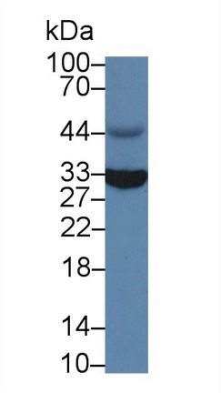 Polyclonal Antibody to Vesicle Associated Membrane Protein Associated Protein A (VAPA)