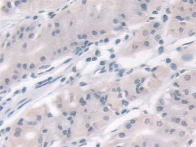 Polyclonal Antibody to Vesicle Associated Membrane Protein Associated Protein B (VAPB)