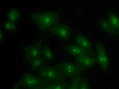 Polyclonal Antibody to Vesicle Associated Membrane Protein Associated Protein B (VAPB)