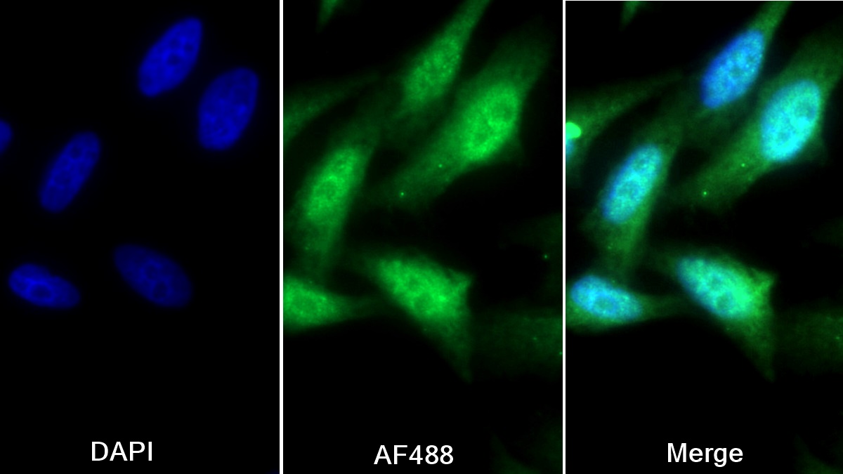 Polyclonal Antibody to YY1 Transcription Factor (YY1)