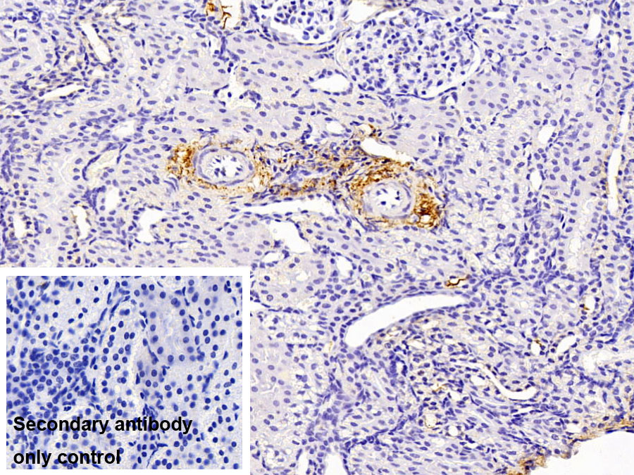 Polyclonal Antibody to Microfibrillar Associated Protein 4 (MFAP4)